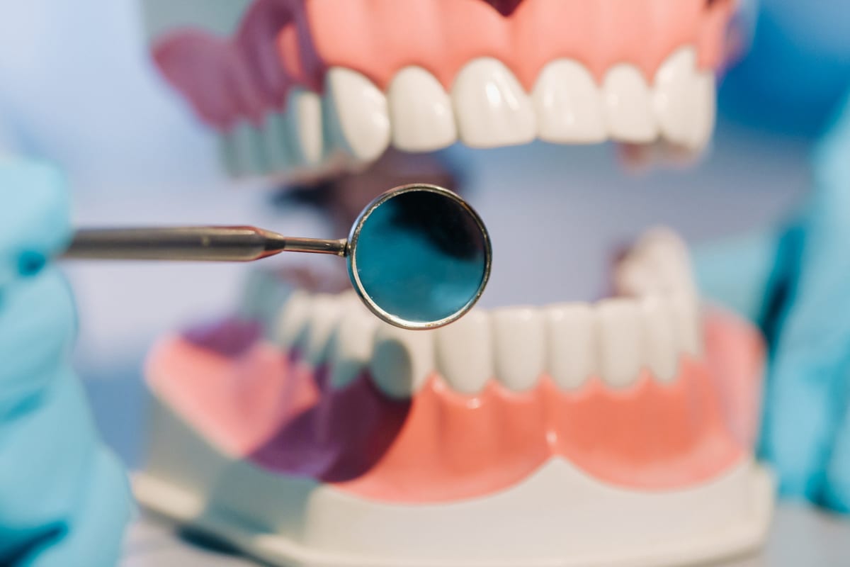 Gum Disease Treatment in San Diego