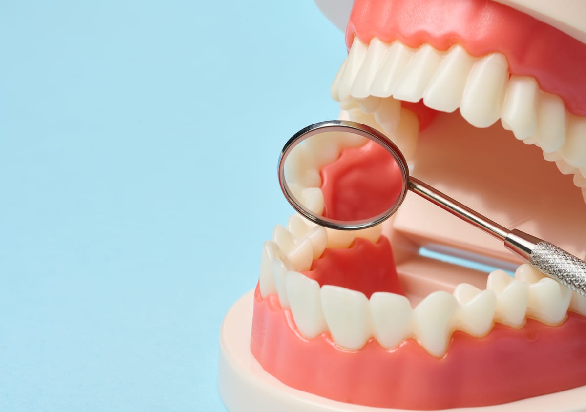 Periodontal Care in San Diego