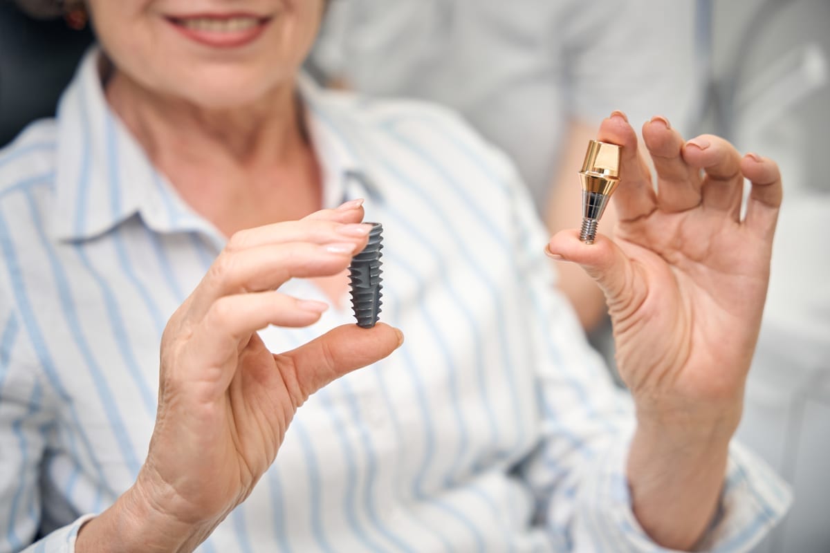 Dental Bridges in Mira Mesa